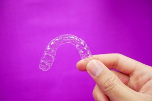 image of clear aligners