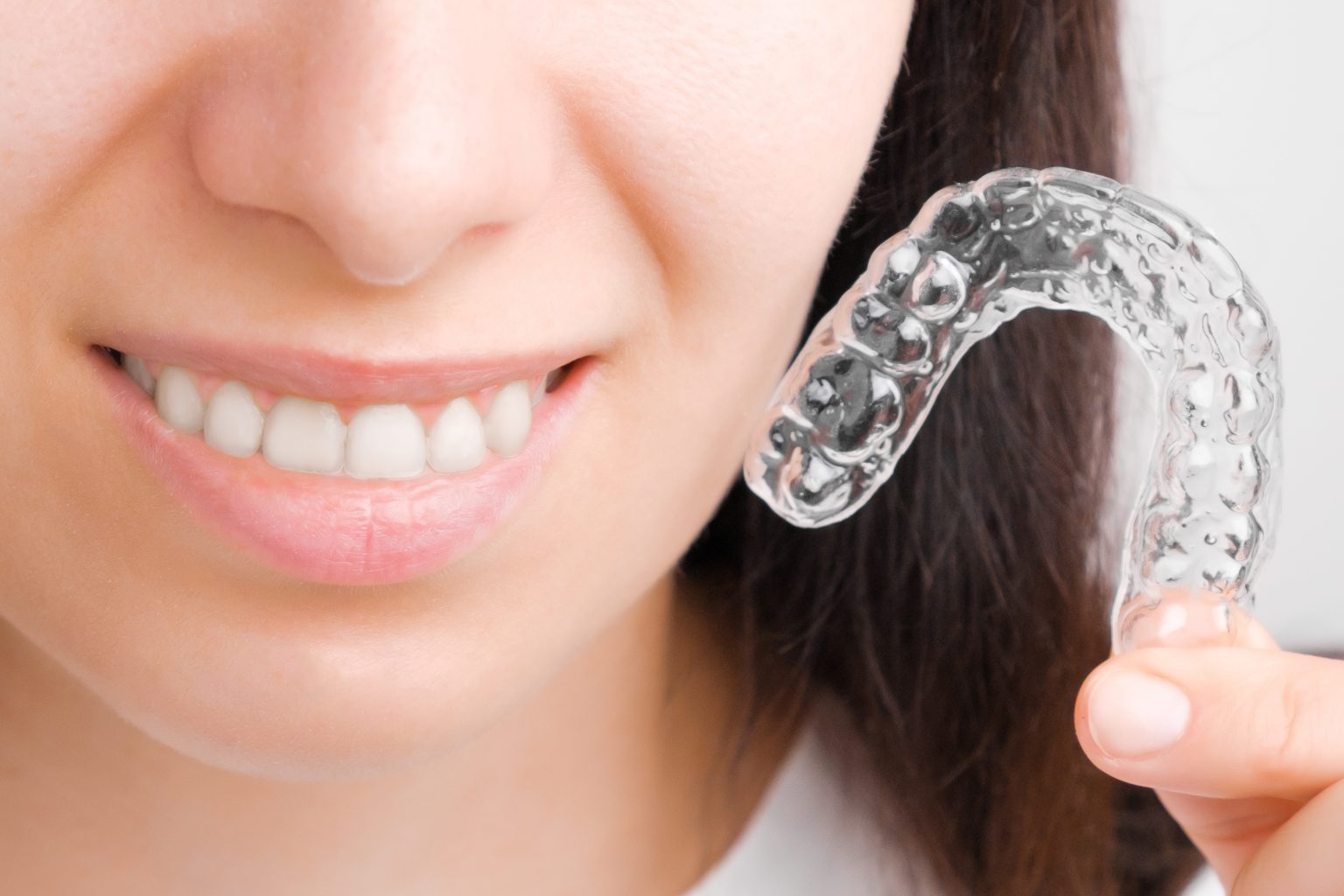 How Suresmile Aligners Help Adults Fix Gaps And Overlaps Prairie