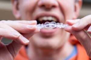 Man holding clear aligners