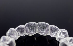 prairie village clear aligners