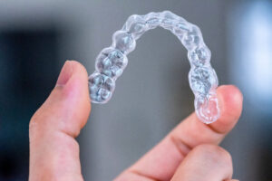 prairie village clear aligners