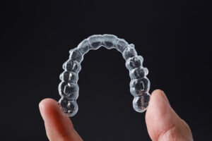 prairie village clear aligners