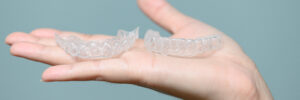 prairie village clear aligners
