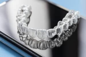 encinitas clear aligners