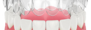prairie village orthodontics