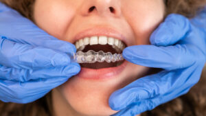 prairie village aligners