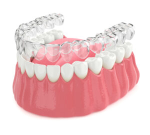 prairie village clear braces
