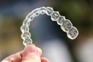 prairie village clear aligners