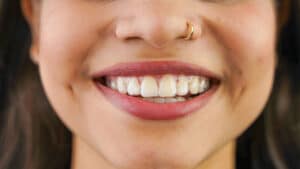 prairie village clear aligners